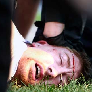 20100626 bleeding protestor detained by toronto riot police.jpg